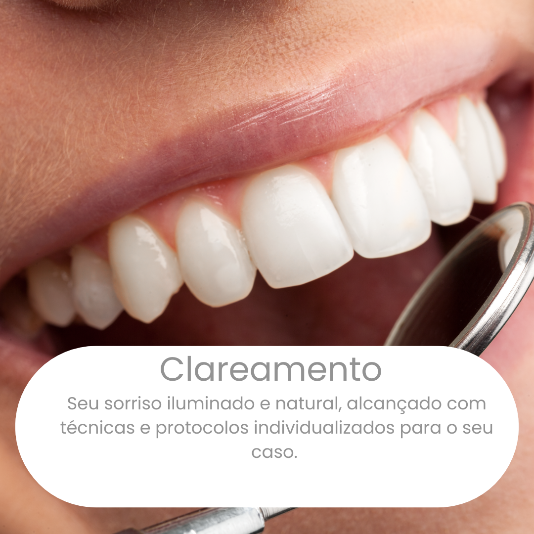 Tratamento de Canal (1)