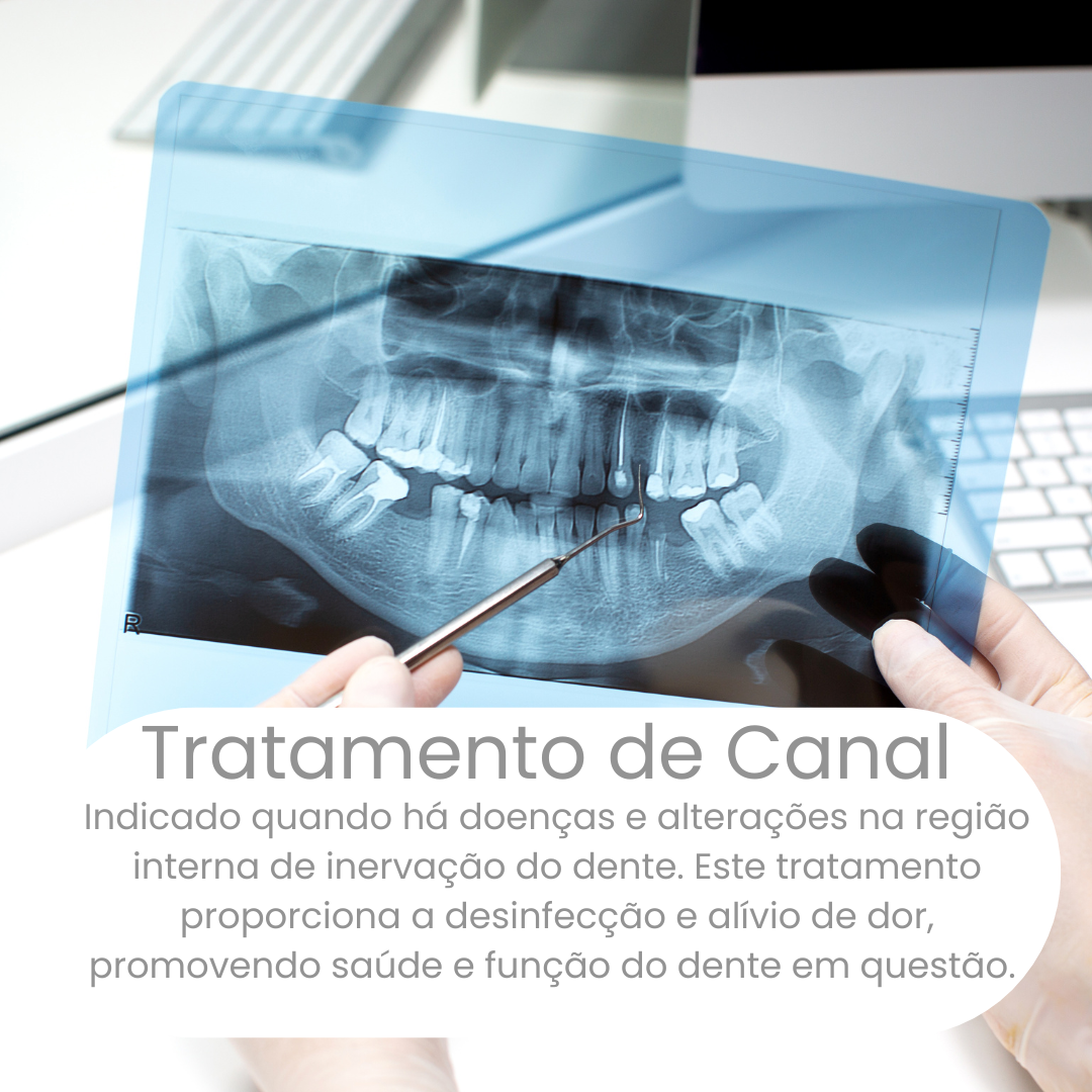 Tratamento de Canal (3)